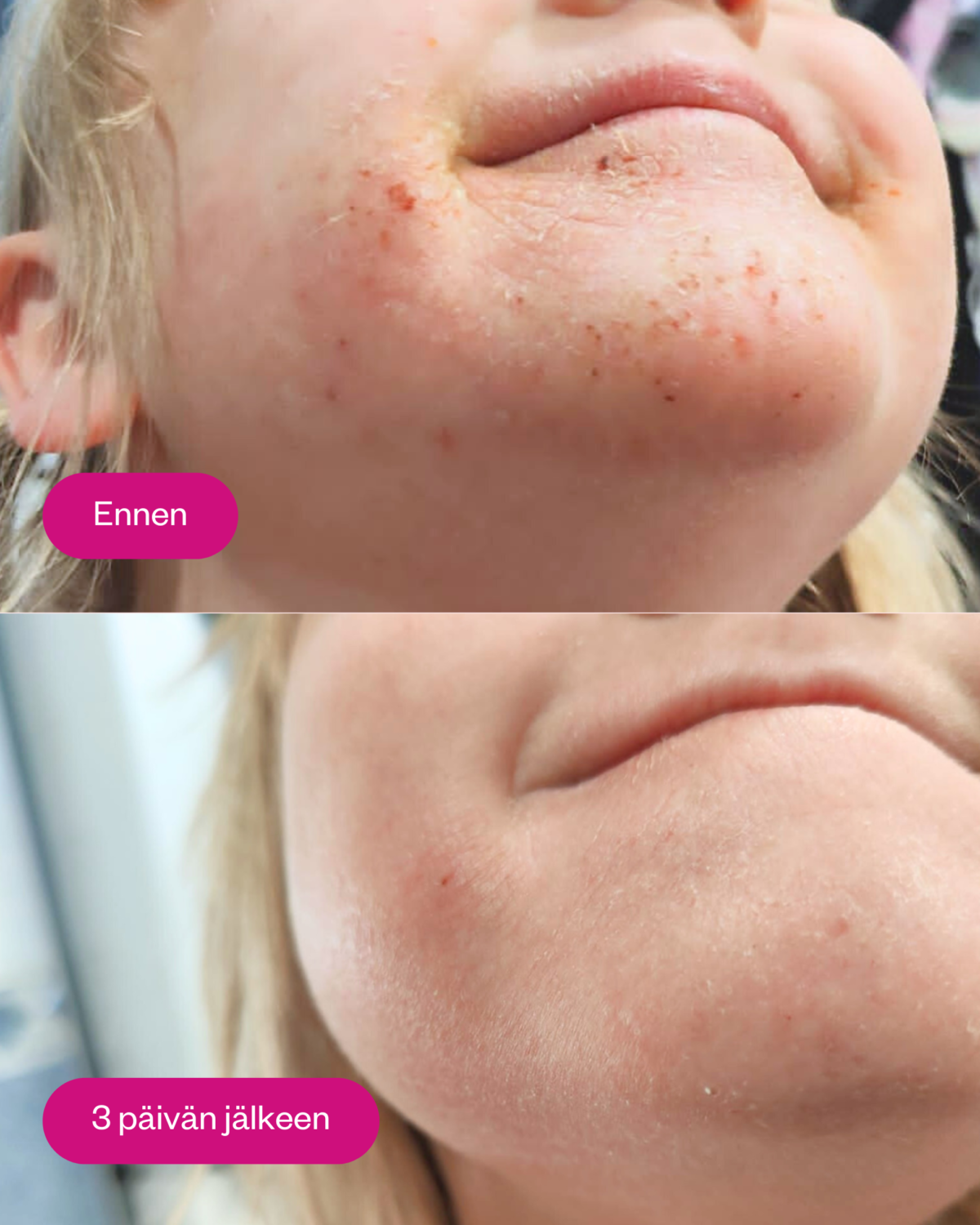 Flow Propolis & Probiotics Rescue Cream 120ml